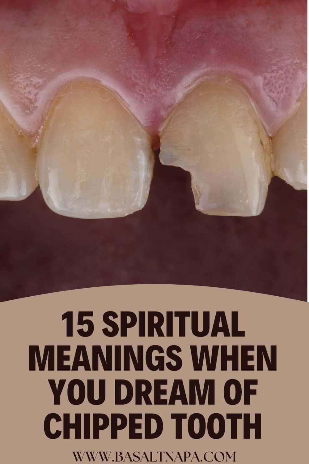 15 Spiritual Meanings When You Dream of Chipped Tooth