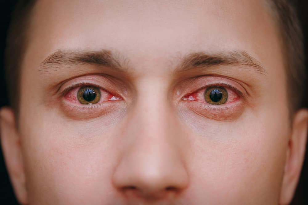 11 Spiritual Meanings When You Dream About Red Eyes